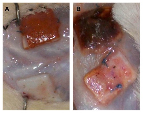 Figure 9 Gross appearance of unmodified and heparin/DHI-modified scaffold sheets at 30 days (A) and 60 days (B) after implantation.Note: The modified scaffolds retain their golden yellow color.Abbreviation: DHI, dihydroxy-iron.