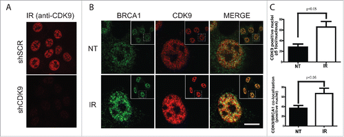 Figure 3. CDK9 IRIF co-localize with BRCA1 at damaged DNA sites. MCF7 cells were exposed to IR (10 Gy) and recovered for 3 hours. Immunostaining was performed using (A) only anti-CDK9 or (B) anti-CDK9 and anti-BRCA1 antibodies. Insets depict the nucleus in lower magnification. ((C)- upper panel) Quantification of CDK9 positive nuclei and ((C)- lower panel) CDK9/BRCA1 co-localization.NT, not treated. Scale bars = 10 μm.