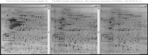 Figure 1.  Demonstration of the effect of depleting highly abundant proteins, in this case by high salt extraction of tubulins and GFAP, on enhanced detection of less abundant proteins (compare, for example, contents of squares before and after extraction).