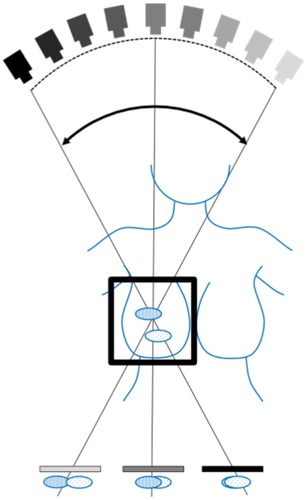 Figure 1 Breast digital tomosynthesis projection acquisition (CC-view): the X-ray source rotates around the static and compressed breast over a limited angular range, while the detector is static or rotates slightly.