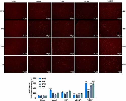 Figure 5. The BDNF/TrkB signaling pathway influenced astrocytes in vestibular nucleus (MVN, IVN, SVN and LVN). (a) Photomicrographs showing GFAP immunostainings in MVN, IVN, SVN and LVN 7 d after unilateral labyrinthectomy with continuous drug infusion in the fourth ventricle (artificial CSF, siBDNF, or 7, 8-DHF). (b) Histograms showing the GFAP immunostaining in both intact and lesioned lateral vestibular nucleus 7d after unilateral labyrinthectomy