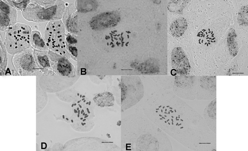 Figure 1. Somatic chromosomes of studied species belonging to the genus Rhaponticoides. (A) R. amasiensis; (B) R. aytachii; (C) R. hierroi; (D) R. iconiensis; (E) R. phytiae. Scale = 10 μm.