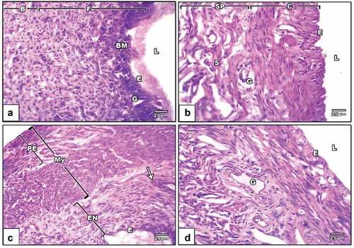 Figure 6. Photomicrographs of a histological cross-section of rat uterine. (a) Negative control displaying uterine architecture with a broad uterine Lumen and undamaged endothelium. (b) PVP-capped AuNRs positive control displaying an intact endometrium with a typical thickness endometrial layer bordered by a simple, high columnar, somewhat ciliated epithelium with basally situated oval nuclei and an underlying dense, highly cellular connective tissue stroma encircling the uterine glands. (c) DMBA carcinogenesis shows different layers; endometrium with leukocytic infiltration (arrowhead) and abnormal thickness, myometrium and perimetrium. (d) DMBA carcinogenesis treated with PVP-capped AuNRs showing the whole endometrium with standard epithelial lining and stroma containing many uterine glands. The magnification power used is 400 × . Abbreviations; BM, basement membrane; L, lumen; E, epithelial cells; G, zona granulosa; F, functional zone; B, basal zone; Sp, spongy zone; C, compact zone; ST, stroma; PE, perimetrium; My, myometrium; EN, the endometrium.