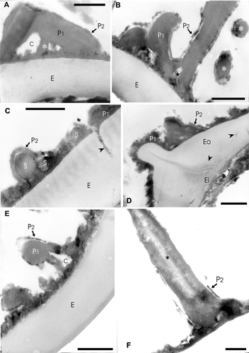 Figure 3 TEM ofAdiantopsis chlorophylla (Sw.) Fée. A–F. The exospore (E) is evident in A to E, its margin is smooth and in section its structure is homogenous. The exospore has uniform thickness and is less contrasted than the perispore. The perispore is two‐layered. The P1 layer is adhered to the exospore and forms the main part of this wall. The layer P2 is thin and covers the inner and outer surfaces of P1. A. In the middle part of layer P1 there are chambers (C) and radial elements (asterisk) of different thickness while this layer is compact towards the outside. The layer P2 is uniform in thickness and its margin is irregular. B. A section that shows spaced elements and those which form the bases of the complex processes of layer P1. Two processes (asterisks) in transversal section can be seen on the right. In both cases the layer P2 covers P1. Spaces of different width are evident in basal part of the processes (star). The spaces are covered with the P2 layer. In the contact between perispore and exospore, short superimposed plates are evident. C. This section crosses a zone with low elements, an interruption in the perispore is also evident that is continuous with a channel (arrowhead) in the exospore (E). This channel is larger in diameter than those at the inner part, and it is filled with helicoidal material of the same contrast as the perispore. (S) points spherules embodied between P1 and P2. D. Section at the laesura level, the exospore thickens and is continuous over the aperture. The perispore is also continuous over the aperture and its margin is irregular according to the sector sectioned. The perispore layer P2 covers P1 and is also continuous on the laesura. At the inner part of the laesura in the exospore, there are thin channels tangentially arranged (arrowheads); other channels are visible in the middle and inner part of the exospore with mainly radial orientation and apparently there exist others that connect each other. E. Detail of a section that shows the exospore and perispore. The layer P1 and P2 are clearly evident. There is a process with a chamber (C) in its base. The inner part of the chamber is covered by P2. F. An echina formed of P1 with a central region of low density (star). The process is covered by P2 which shows different degrees of development on the same spore. Scale bar – 1 µm (A–F).