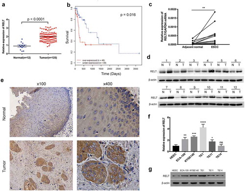 Figure 1. Expression of RELT in the ESCC tissues. (a) Expression levels of RELT in the normal esophageal tissues (n = 12) and the ESCC samples (n = 123) from the TCGA database were analyzed. (b) Survival analysis for patients with low- or high- expression levels of RELT, by the Kaplan-Meier method and the log-rank test. (c) The mRNA and (d) protein expressions of RELT in the paired ESCC and the corresponding normal tissues as determined by qRT-PCR and western blot. (e) Representative images of the IHC stained-normal esophageal and the IHC stained-ESCC tissues. (f) The mRNA and (g) protein expressions of RELT in the HEEC, ECA-109, KYSE140, TE-1, TE11, and TE-14 cell lines as detected by qRT-PCR and western blot