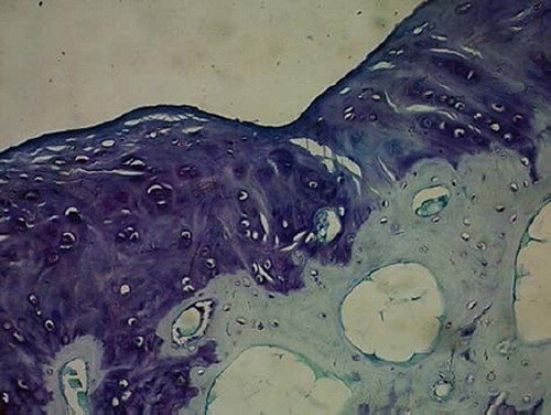 Figures 4. Sagittal sections of cartilage defects transplanted with MSCs derived from syanovium (3) at 12 weeks (toluidine blue staining × 400).