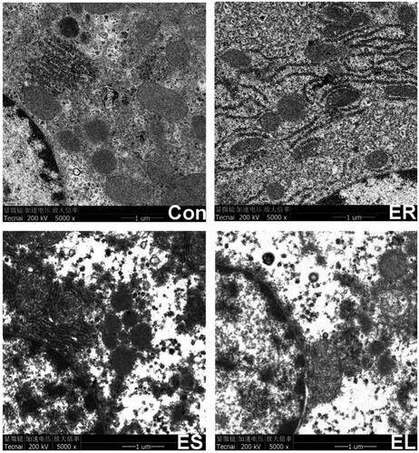 Figure 9. Electron micrograph of the liver tissues (5000×). The rats were treated with the ethanol extracts of different parts of C. serratus (ER: 4.14 g/kg/day, ES: 3.20 g/kg/day and EL: 1.16 g/kg/day) for 14 days. The Con group: normal structure; the ER group: mild expansion of the endoplasmic reticula; the ES group: mitochondrial structure deformation; the EL group: severely dilated, no intact structure.