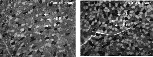 Figure 3. Representative photomicrographs of the GS in control group (A) and AICAR group (B). Cross-sections of GS muscle stained for myosin ATPase after pre-incubation in pH 4.60–4.65. Magnification of 200× was used (bar = 200 μm). I: fiber type I, black; IIA: fiber type IIA, white; IIB: fiber type IIB, brownness. n = 13 muscles per group.