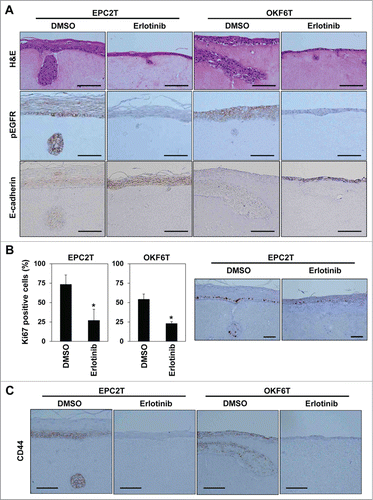 Figure 4. Erlotinib suppressed tumor growth and invasion as well as enrichment of CSCs in organotypic 3D culture. EPC2T cells and OKF6T cells were cultured in organotypic 3D culture system with or without erlotinib (5 μM). (A) Tissues were stained by hematoxylin and eosin (H&E) (upper panels), anti-phospho EGFR antibody (middle panels) and anti-E-cadherin antibody (lower panels). Scale bar indicates 100 μm. (B) Cell growth was evaluated by Ki-67 staining. Histograms show percentage of Ki-67 positive cells at the basal layer. Scale bar indicates 100 μm. (*P < 0.05 vs. DMSO control) (C) Tissues were stained by anti-CD44 antibody. Scale bar indicates 100 μm.