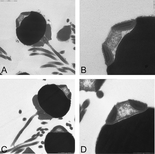 Figure 7. TEM micrographs of the mature spermatozoa and details of the acrosome of a male of Lysidice caribensis (A, ×5000; B, ×10,000) and of Lysidice adrianae (C, ×5000; D: ×10,000). Note for both species the typical ect-aquasperm structure.