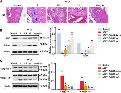 Figure 1 Sal improved cartilage injury by promoting chondrocytes proliferation in OA rats. Rats were divided into five groups (n=10): Control group (Healthy rats were given saline treatment); ACLT, ACLT model; ACLT + Sal (12.5 mg/kg), OA rats were treated with 12.5 mg/kg Sal; ACLT + Sal (25 mg/kg), OA rats were treated with 25 mg/kg Sal; ACLT + Sal (50 mg/kg), OA rats were treated with 50 mg/kg Sal. (A) Cartilage injury was analyzed by H&E staining. (Magnification × 400). (B) Levels of proliferation marker proteins (Ki67 and PCNA) were measured by Western blotting. (C) Levels of apoptosis marker proteins (Caspase-3 and Caspase-9) were measured by Western blotting. β-actin was employed as an internal reference. (**P < 0.01 vs control group, #P < 0.05, ##P < 0.01 vs ACLT group).