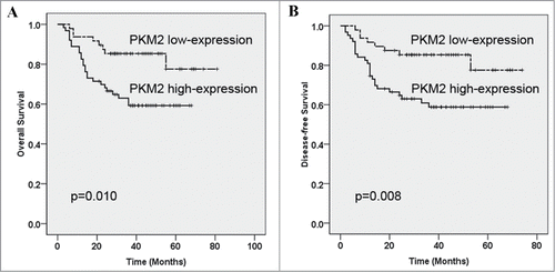 Figure 3. Kaplan-Meier graphs representing the probability of cumulative overall and disease-free survival in OSCC patients based on PKM2 expression. (A) High PKM2 expression significantly associated with reduced overall survival in OSCC patients. (B) High PKM2 expression associated with reduced disease-free survival in OSCC patients. These survival analyses were estimated by Kaplan-Meier method and compared with log-rank test.
