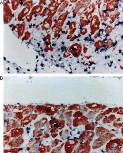 Figure 4.  A,B. Immunohistological double staining for BrdU(+) cell nuclei and β-MHC(400×): ellipse type, intense red cytoplast (AEC), nucleus with cavity forms, karyotheca and cell membrane should be complete, nucleolus of BrdU(+) nuclear submits dark purple color (NBT), dyed deeply, and are located l in the center of nuclear.