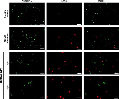 Figure 5 Detection of apoptosis in human breast cancer cells by BisBAL NPs.Notes: Apoptosis induction in MCF-7 cells by BisBAL NPs was detected with the CF®488A Annexin V and 7-AAD apoptosis assay. Etoposide at 100 µM was used as a positive control of an apoptotic agent, whereas pure culture medium was used as a negative control; 1 and 10 µM BisBAL NPs were analyzed on MCF-7 cells. After treatments, cell cultures were observed with a fluorescence microscope using fluorescein isothiocyanate (green) and CY5 (red) filters. Bar, 5 µm.