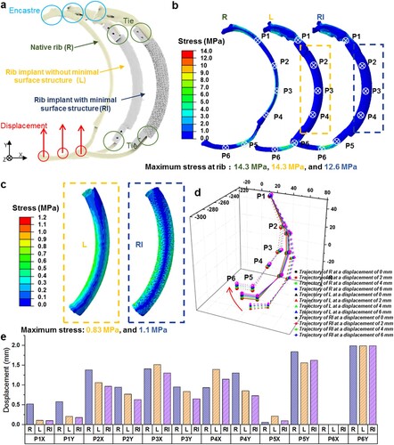 Figure 3. Computational simulation of the mechanical responses of the designed PCL RI at the implantation site. (a) The boundary conditions for simulating the mechanical responses of L and RI at the implantation site. (b) Contour plot of von Mises stress and displacement predicted for the three FE models corresponding to R, L, and RI. (c) Contour plot of von Mises stress predicted for the load-bearing structures of L and RI. (d) The deformation patterns and (e) quantitative results of the displacement of different representative points for models with R, L, and RI at identical boundary conditions.
