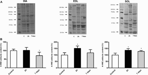 Figure 2. Evolution of 4-hydroxynonenal (4-HNE) in DIA, EDL, and SOL muscles 2 hours and 7 days after CLP. (a) Representative immunoblots of 4-HNE in skeletal muscles. (b) Means ± SD of 4-HNE adducts. n = 5–6 per group. Values expressed as fold change relative to control group, P < 0.05 as compared to control group.