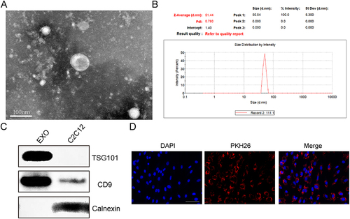 Figure 1 Identification of exosomes derived from C2C12. (A) Transmission electron microscopy (TEM) was used to identify the morphology of C2C12-Exos (Scale bar = 100 nm). (B) Exosome size distribution was determined through the utilization of nanoparticle tracking analysis (NTA). (C) Western blot analysis of the surface biomarkers CD9, TSG101 and Calnexin. (D) Cells phagocytosed C2C12-Exo labeled with PKH26 (Scale bar=100μm).