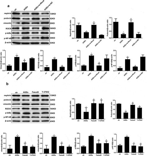 Figure 9. Effect of si-RhoA or ROCK inhibitor on the NF-κB signalling pathway and cell injury. (a) Nephrin, podocin and vimentin protein expression and the phosphorylation of NF-κB/p65, IκBα and ROCK in HPCs were detected by western blot; β-actin served as an internal control. si-RhoA could efficiently restore their expression. (b) The ROCK inhibitor fasudil and Y-27,632 could significantly restore the expression of the above molecules, which were induced by AGE. (Data are the mean ± S.D.; *P < 0.05 vs control, #P < 0.05 vs AGE. n = 3)