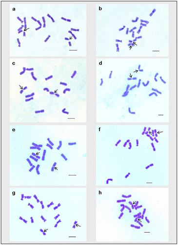 Figure 1. Giemsa stained somatic metaphase plates of different cultivars of Lens culinaris. (a) DPL-15; (b) DPL-62; (c) IPL-406; (d) IPL-526; (e) HUL-57; (f) EC-70306; (g) EC-70394; (h) EC-70404. Arrows indicate chromosomes with two constrictions. Bar = 5 μm.