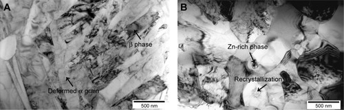 Figure 3 TEM images of middle region (~1 mm from upper surface) of stir zone in Zn-I-FSP group alloy.Notes: (A) Deformed grain and (B) recrystallization grain.Abbreviations: FSP, friction stir processing; TEM, transmission electron microscopy; Zn, zinc.