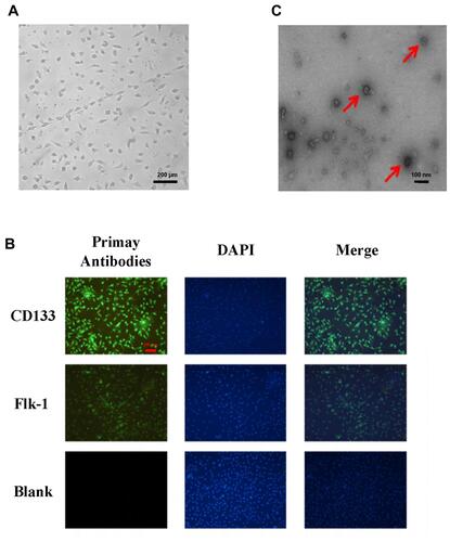 Figure 1 Identification of EPCs and EPC-derived exosomes. (A) EPC morphology was observed under an optical microscope. (B) Images of the EPC surface-specific proteins CD133 and Flk-1 were captured by immunofluorescence microscopy, with DAPI (4′,6-diamidino-2-phenylindole) used to visualize cell nuclei. (C) EPC-derived exosomes were identified by their morphological features under an electron microscope, and the diameters were measured (magnification, 200×). The vesicles shaped like a cupholder are exosomes, as indicated by the red arrows.