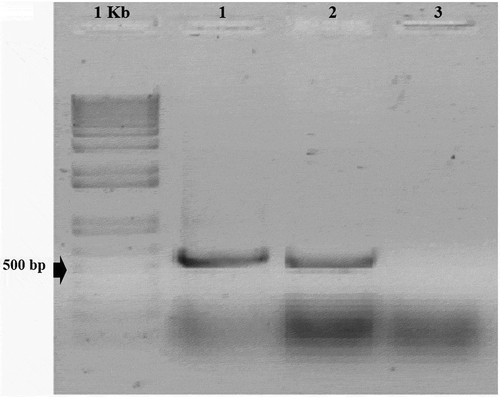 Fig. 1 Agarose gel electrophoresis of PCR products for detection of Bean golden mosaic virus (BGMV). Primers specific for the DNA-A coat protein gene of the virus were used in the PCR analysis and amplified a 550 bp product. The gel was stained with SYBR Gold nucleic acid gel stain. Lane labelling is as follows: 1Kb – molecular weight marker; 1 – amplification from a bean plant of cultivar ‘Carioca’ showing mosaic and wrinkling symptoms; 2 – positive control; 3 – negative control (no DNA included in reaction mixture)