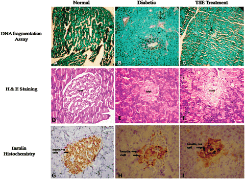 Figure 5  . Effect after 4 weeks daily dosing of Tamarind seed extract on apoptosis [deoxynucleotidyltransferase-nick-end-labelling (TUNEL) assay] changes in the pancreata of diabetic rats; Hematoxylin and eosin staining and anti-insulin antibody immunostaining from (A, D, G) normal (B, E, H) vehicle-treated diabetic rats, and (C, F, I) TSE-treated diabetic rats, respectively. Original magnification ×400. H&E, hematoxylin and eosin.