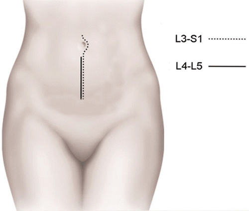 Figure 3. Incision for the ventral trans- or extraperitoneal surgical approach for the disc implantation.