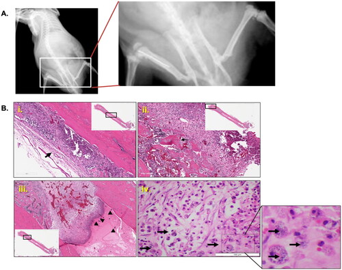 Figure 4. Establishment of the rat model of MRSA biofilm implant-associated osteomyelitis. (A) Radiograph at 10 days post-infection showed signs of periosteal reaction, osteolysis and swelling in the infected right femur compared to the uninfected left femur. (B) Histopathological changes in the rat model of osteomyelitis in the femur illustrated salient features of osteomyelitis: (i) extensive inflammation and fibrosis in the periosteal lining of the bone; (ii) pieces of necrotic bone (black arrow) surrounded by micro-abscess, inflammation and fibrosis; (iii) inflammation and presence of clumps of bacteria (black arrowheads) in the distal end of the femur; (iv) presence of immune cells with intracellular bacteria (black arrows). Scale bars = 100 µm.