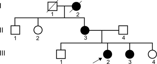 Figure 2 Pedigree chart of the X-linked Alport syndrome.