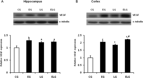Figure 7. Changes in VEGF protein expression in the hippocampus and cortex after low-intensity treadmill exercise and bright light exposure. Western blots of VEGF proteins from lysates of rat hippocampus (A) and cortex (B) and their quantification. a, p < 0.05, b, p < 0.01, c, p < 0.001 vs. control group and #p <0.001 vs. exercise group and light group. CG, control group; EG, exercise group; LG, light group; ELG, exercise plus light group.