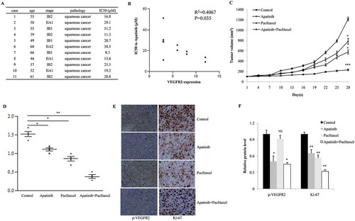 Figure 6. Apatinib suppresses the growth of SiHa xenografts in vivo. (a) As the CCK-8 assay shown, 5 of 11 primary cervical cancer tissues showed significant sensitivity to Apatinib (IC50 < 20 μM); (b) these cancer tissues with higher level of VEGFR2 were more sensitive to Apatinib (R2 = 0.4067, P = 0.035); (c) In a nude mouse model, the single use of Apatinib or Paclitaxel significantly suppressed the growth of SiHa xenografts, and the combination with the 2 drugs further augmented this effect (P = 0.043, 0.031 and <0.001, respectively); (d) Compared to the control group, tumor weights in the Apatinib group and Paclitaxel group were significant lower (P = 0.05 and 0.024, respectively), and the tumor weights in the combination group were the lowest (P = 0.007); (e and f) As IHC shown, the phosphorylation of VEGFR2 was positive in the control group and Paclitaxel group (P = 0.033 and 0.019, respectively), but was notably inhibited in Apatinib group and combination group. In addition, Ki-67 (a proliferative marker) was suppressed by the single treatment with Apatinib or Paclitaxel, and was further decreased in tumors treated with Apatinib plus Paclitaxel (P = 0.041, 0.029 and 0.005, respectively)