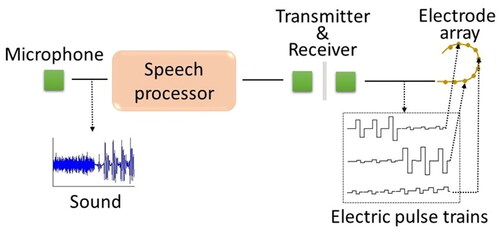 Figure 1. Illustration of signal transmission in cochlear implants.