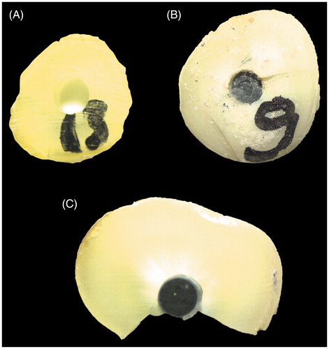 Figure 1. Representative images for the failures. (A) Adhesive failure (between the cement and root dentin), (B) cohesive fracture (within the dentin, cement layer or post) and (C) mixed (a combination of cohesive and adhesive).