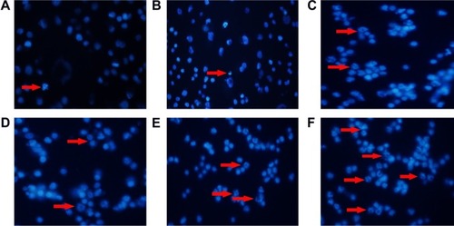 Figure 6 Morphological characterization of RPMI-8226 cells treated with and without MNPs for 48 hours by DAPI staining. The cells were visualized under fluorescence microscopy (×200). (A) control; (B) 60 mg/L DMSA-Fe3O4; (C) 2.5 nM BTZ; (D) 0.2 μM GA; (E) 2.5 nM BTZ-0.2 μM GA; (F) 2.5 nM BTZ-0.2 μM GA-60 mg/L DMSA-Fe3O4.Note: Red arrows indicate apoptotic cells within the cell populations.Abbreviations: DMSA-Fe3O4 MNPs, dimercaptosuccinic acid modified iron oxide magnetic nanoparticles; DAPI, 4,6-diamidino-2-phenylindole; BTZ, bortezomib; GA, gambogic acid; BTZ-GA, bortezomib-gambogic acid; BTZ-GA/MNPs, bortezomib-gambogic acid/dimercaptosuccinic acid modified iron oxide (DMSA-Fe3O4) magnetic nanoparticles.