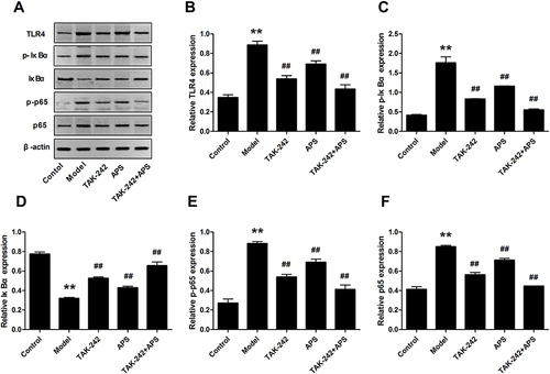 Figure 8 Effects of APS on the expression of TLR4/NF-κB pathway in HG-induced podocytes. (A) Western blotting for the protein of TLR4/NF-κB pathway. (B–F) TLR4, p-IκBα, IκBα, p-p65 and p65. **P<0.01 vs control, ##P<0.01 vs model.