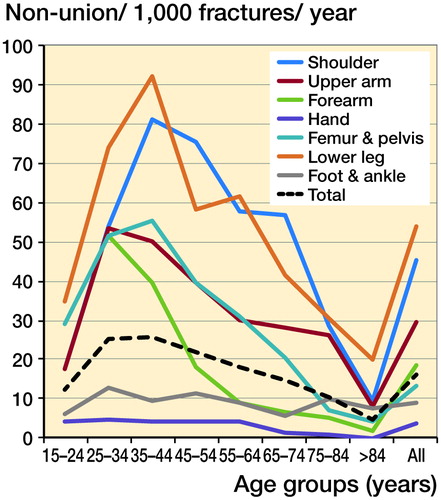 Figure 5. Incidence of non-union per 1,000 fractures, according to ISD-10 anatomical distribution.