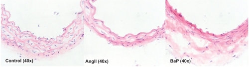 Figure 3 Damage of the arterial wall by AngII or BaP treatments. We show representative images of the aortic wall at the suprarenal segment of the aortas obtained from control, AngII-treated, and BaP-treated mice. Compared to control animals, the medial layer of aortas from AngII-treated mice and BaP-treated mice was shrunken; elastic lamella lost fine lines and instead degraded into loosely defined lines. These changes were particularly severe in aortas from BaP-treated mice, with fewer cells (VSMCs) seen in the medial layer. In adventitia, there were some cells with a rounded-shaped nucleus, resembling inflammatory cells. Although the medial layer of the aortas from BaP-treated mice was severely damaged, the adventitia of the arteries was thicker.