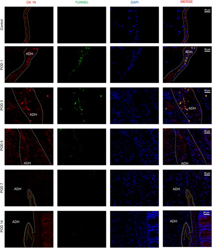 Figure 6. Representative images of the mesothelial cell layer and apoptosis in the peritoneal tissue and adhesions visualized by immunofluorescence staining (40×). The yellow lines indicate mesothelial cells, and adhesions (ADH) are indicated by gray boxes (mesothelial cells are characterized by the expression of cytokeratin 19 (CK 19)).