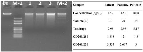 Figure 3. Gel electropherogram and the quality of sample DNA for Sequencing.