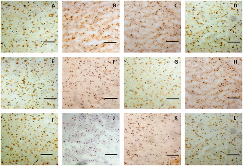 Figure 8. Representative immunohistochemical images of ZO-1 in the brain tissue of glioma rat after borneol exposure at different time points: (A) 5 min in the control group, (B) 30 min in the control group, (C) 45 min in the control group, (D) 2 h in the control group, (E) 5 min in the low-borneol group, (F) 30 min in the low-borneol group, (G) 45 min in the low-borneol group, (H) 2 h in the low-borneol group, (I) 5 min in the high-borneol group, (J) 30 min in the high-borneol group, (K) 45 min in the high-borneol group and (L) 2 h in the high-borneol group. Scale bars, 100 μm.
