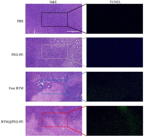 Figure 7 Histopathological confirmation of efficient therapeutic efficacy of BTM@PEG-PE micelles against CT26 tumor. H&E and TUNEL-stained tumors of mice after treatment (scale bar =500 μm).