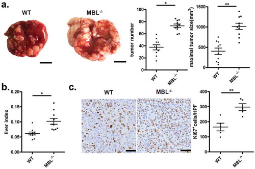 Figure 1. MBL deficiency promotes tumor growth in a murine HCC model.WT (n = 10) and MBL–/– mice (n = 10) received a tail vein intravenously injection of 2 × 106 Hepal-6 cells. After 3 weeks, mice were sacrificed and the visible liver tumor nodules, maximal tumor size (a) and liver index (b) were examined. Scale bars, 1 cm. (c) Analysis of Ki67 positive cells in tumor tissues by immunohistochemistry (each dot represents the average of 10 HPFs). Scale bars, 50 μm. Data are presented as means ± SEM (horizontal lines). HPFs, high-power fields; *, P < 0.05; **, P < 0.01.