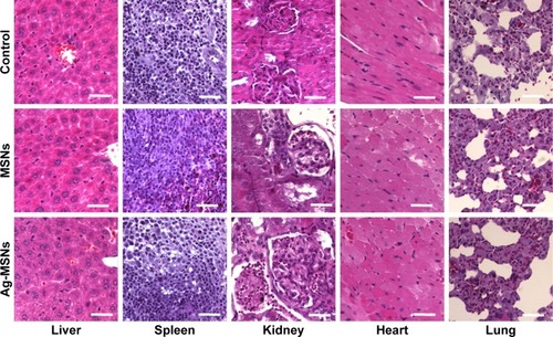 Figure 12 Representative H&E-stained images of major organs, including the liver, spleen, kidneys, heart, and lungs, collected from control mice.Notes: MSN-treated mice, and Ag-MSN-treated mice after 30 days of treatment. The scale bars represent 50 µm.Abbreviations: Ag-MSNs, silver-decorated mesoporous silica nanoparticles; MSNs, mesoporous silica nanoparticles.