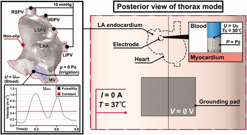 Figure 4. Boundary conditions of electrical, thermal and fluid problems in the ablation model. LAA: left atrial appendage; LSPV/LIPV/RSPV/RIPV: left superior/left inferior/right superior/right inferior pulmonary vein; MV: mitral valve.