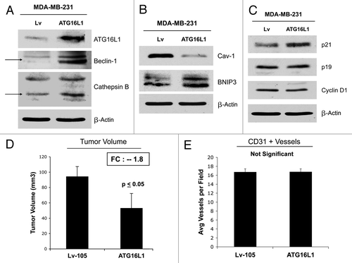 Figure 14. ATG16L1 expression in human breast cancer cells drives autophagy and reduces tumor growth. (A, B) To understand the compartment-specific role of autophagy in tumor growth, we also stably overexpressed ATG16L1 in human breast cancer cells. ATG16L1 overexpression in MDA-MB 231 cells, by itself, is indeed sufficient to drive autophagy and mitophagy under baseline cell culture conditions, as evidenced by the loss of Cav-1 expression and the upregulation of BNIP3 (B). Similarly, MDA-MB 231 cells harboring ATG16L1 display the upregulation of certain autophagy markers (Beclin1 and CTSB), after overnight starvation (A). (C) Note that ATG16L1 overexpression in MDA-MB-213 cells induces p21 expression, but no significant changes were detected in p19 and/or Cyclin D1 protein levels. (D) We also assessed the capacity of autophagic MDA-MD-231 cells to undergo tumor growth in vivo, after implantation in the flanks of nude mice. Note that ATG16L1 overexpression caused a near 2-fold reduction in tumor volume. (E) However, we did not observe any differences in tumor neo-vascularization, as assessed by quantitation of CD31-positive vessels.