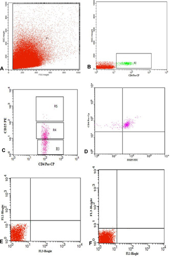 Figure 2 Gating strategy to identify regulatory T cells in tumor tissue. (A) The lymphocyte population was selected by R1. (B, C) CD4+ cells among the gated lymphocytes were selected by (R2) then (R3), (R4) and (R5) were drawn to identify CD4+cells with no, low and high CD25 expression, respectively. (D) Dot plot representing FoxP3 expression among the CD4+CD25+high cells to detect Tregs (CD4+CD25+high FoxP3+). (E, F) Representative dot plots of isotype control.