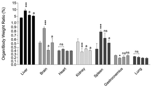 Figure 2. Organ weight index in cirrhotic rats. Columns of weight index for each organ indicate sham-operated, BDL, BDL + NAC 100 mg/kg, and BDL + NAC 300 mg/kg respectively (left to right). Data are represented as mean ± SD (n = 8). Asterisks indicate significantly different as compared with the control group (*p < 0.05, **p < 0.01). aIndicates significantly different as compared with the BDL group (p < 0.01). ns: not significant as compared with the BDL group.