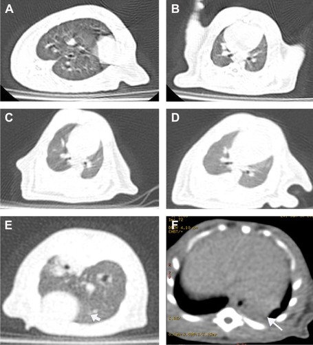 Figure 7 Thoracic CT images of rats.Notes: (A, B) Computed tomography (CT) images from the rats in the control groups (saline and polyacrylate), the rats’ lung texture is clear. (C, D) CT images from the rats in the low- and intermediate-dose groups – no pleural effusions were observed. (E, F) CT images from a rat in the high-dose group show that there is no water in the pleural cavity, but there is blunting of the posterior costodiaphragmatic angle. The arrow represents signs of grinding glass (E) and blunting of the posterior costodiaphragmatic angle (F).