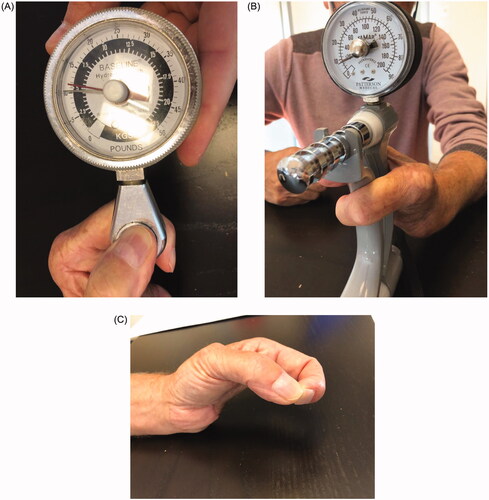 Figure 5. (A) The key pinch test with a thumb-index force at 5.5 kg. (B) The Jamar hand dynamometer with a grip force of 10 kg. (C) The pincer grasp of the patient.